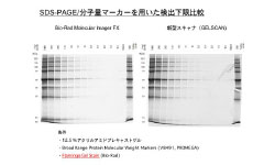 DNA蛍光染色：SYBR Gold